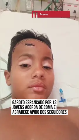 O Pablo tem somente 11 anos, mas acabou de passar por experiência que nenhuma criança no mundo deveria vivenciar. Um grupo de 13 jovens foi até a casa do pequeno, em #CaldasNovas (GO), tirar satisfação com o irmão mais velho de Pablo, mas foi o caçula que mais se prejudicou. A criança foi covardemente agr3dida, sofreu traumatismo craniano e ficou uma semana em coma.  Recentemente, o garotinho acordou e agradeceu o apoio dos seguidores da #internet.  No #vídeo, o pequeno fala sobre as orações e recebidas e ressalta o quanto está grato. Mas apesar das boas notícias, a mãe do Pablo tem tido dificuldades para manter as contas da casa em dia. Desempregada e com cinco filhos para criar, os boletos estão chegando e manter um dos herdeiros no hospital tem se tornado uma tarefa cada vez mais desafiadora. #EntretêNews Vamos ajudar? Pela Chave Pix: pablo@ajud.ar Ou No site: ajud.ar/pablo Melhoras, Pablo! 📹 @kkamila_barros (ig) | @myhoodbr