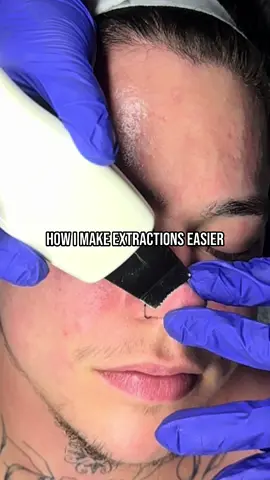 When a client needs deeper extractions, I focus on skin prep — not pressure. I use this Korean professional skincare mask from KRX, called the Pre-Extraction Softening Mask. It’s designed to gently loosen congestion, soften sebum, and make extractions smoother and less traumatic on the skin. ✨ Pro tip: Instead of steam, I occlude it with plastic wrap for 5–7 minutes. The occlusion traps warmth and hydration, creating a gentle micro-steam effect that helps soften pores without overheating or dehydrating the skin. This step makes a noticeable difference in how easily impurities release and how calm the skin looks afterward. It’s one of those quiet, behind-the-scenes tricks that keeps your results clean, fast, and barrier-safe. #koreanskincare #extractions #estheticiantips #estheticiantiktok #esthetician 