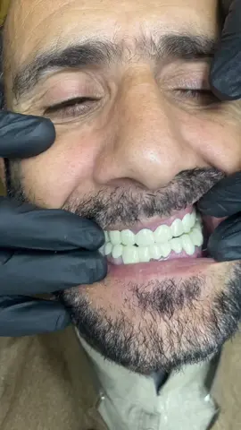 #foryoupage❤️❤️ #peshawar #dentist @Dr- syed numan official✅✅ @DrSyedAdnan2244 