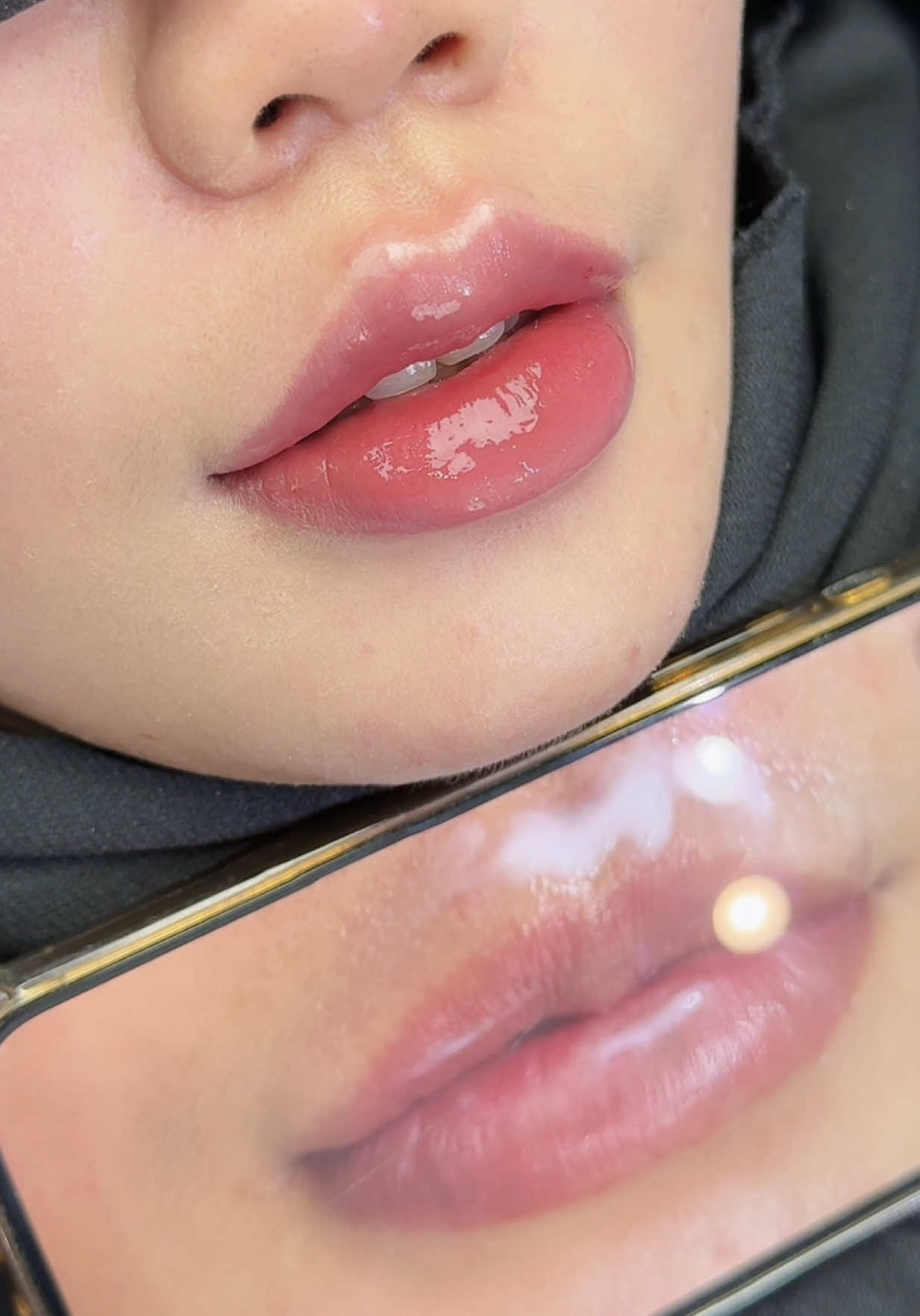 Đôi môi này có làm bạn mê mẩn, nhà m ưu sự tự nhiên ạ,vẫn đảm bảo môi đứng fomr đỉnh rõ khoé cong ạ #moithietke #moibaby #moitunhien #tiemmoidep #xuhuongtiktok 