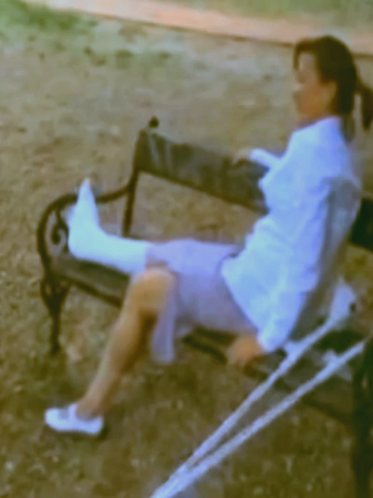 #gipsfuß #cast #crutches #krücken #platre #gips #gesso