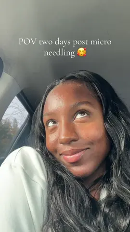 #athomemicroneeedling 