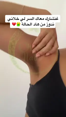 السر الي خلاني من تصبغات سنين ونوصل لهاد النتيجة 👌#تصبغات #تفتيح #السعوديه #توحيد_لون_البشره #الامارات 