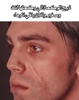 حصل وعندي على حلكي بس خفيفة #شتبوست #شتبوستر_عظيم #اكسبلورر #ocd #explore 