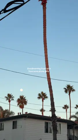 MORNING! #realisticroutineswithken #confidentwithken #acneproneskin #acnesupport #morningroutine 