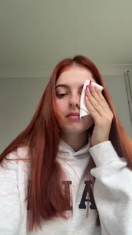 This is horrible, literally came out of no where it started off a bit last night and then through the night I couldn’t see too well and then woke up like this #eye #mama #ivfmama #ivfbaby #eyeproblem 