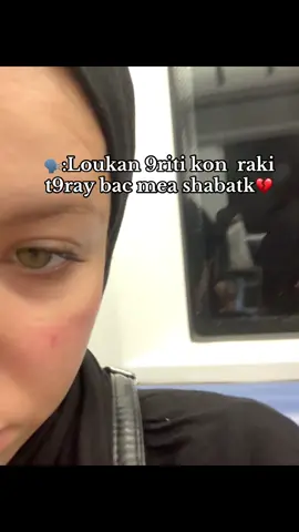 💔💔#bac #foryou #viral 