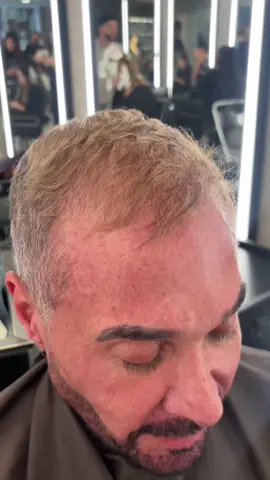 #CapCut #preenchimentocapilar #cabelomasculino #antesedepois @DCONCEPT 