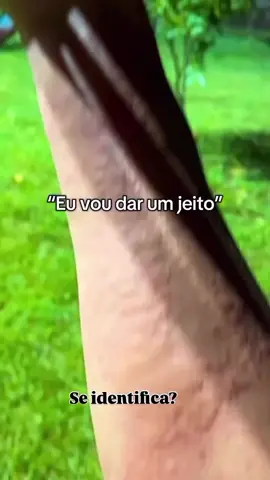 Você tenta dar conta de tudo… mas quem é que dá conta de você? A sobrecarga nem sempre aparece em palavras, às vezes, ela se manifesta na pele. Coceiras, placas avermelhadas, sensação de ardência… sintomas que podem parecer “físicos”, mas que muitas vezes são o grito do emocional pedindo socorro. A urticária emocional é um exemplo claro disso: o corpo responde ao estresse, à ansiedade e à tensão acumulada com sinais visíveis. E o mais curioso? Quase sempre ignoramos esses sinais, tratando apenas o sintoma, sem olhar para a causa. O que seu corpo está tentando te dizer? 🧠 Você já passou por algo assim?  #urticariaemocional #saudemental #emocaoepele #beleza #cuidadoscomapele 