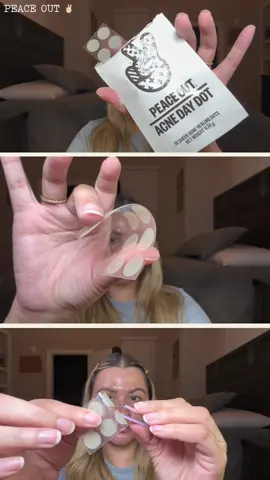 ✨ Peace Out Skincare – Acne Healing Dots ✨ These patches are miniature magic 🪄. They soothe, reduce inflammation, and help dry out pimples while you sleep 😴💫. Clearer skin without even touching your face! 💖 @PeaceOutSkincare  Available now @sephora #PeaceOutSkincare #peaceoutpartner #peaceoutacnedots 