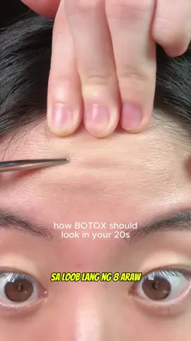 Pampawala ng wrinkles, ito ang gamitin! Pwede mong i-click 'yung product link sa right-bottom ng ad, o kaya check out mo sa shopping cart sa aking homepage! May discount! #botox#botoxnatural#botoxcheck#botoxinabottle#beevenom#TikTokPhilippines#PinoyTikTok jr1107-2