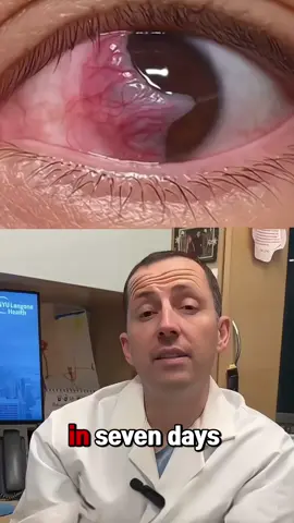 I've been using these lutein! #Lutein#eyehealth#Missionhillfoods#oxynergy #lutein 