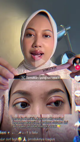 gue pengguna lama eyelinernya pinkflash, banyak produk pinkflash yang gua suka karena bagus dan affordable. udah 3 tahunan gua pake. tapi aman2 aja sebenernya. cuma emang gatauu kenapa sejak agustus lalu, tiap gua pake eyeliner, itu mata selalu merah, perih, terus jadi banyak belek nya. pas berenti pake eyelinernya, matanya sembuh. gitu aja terus. eh taunya viral kalo produknya ga aman😭 mana gue dulu sempet pake eyeshadow nya lagi sampe abis :))