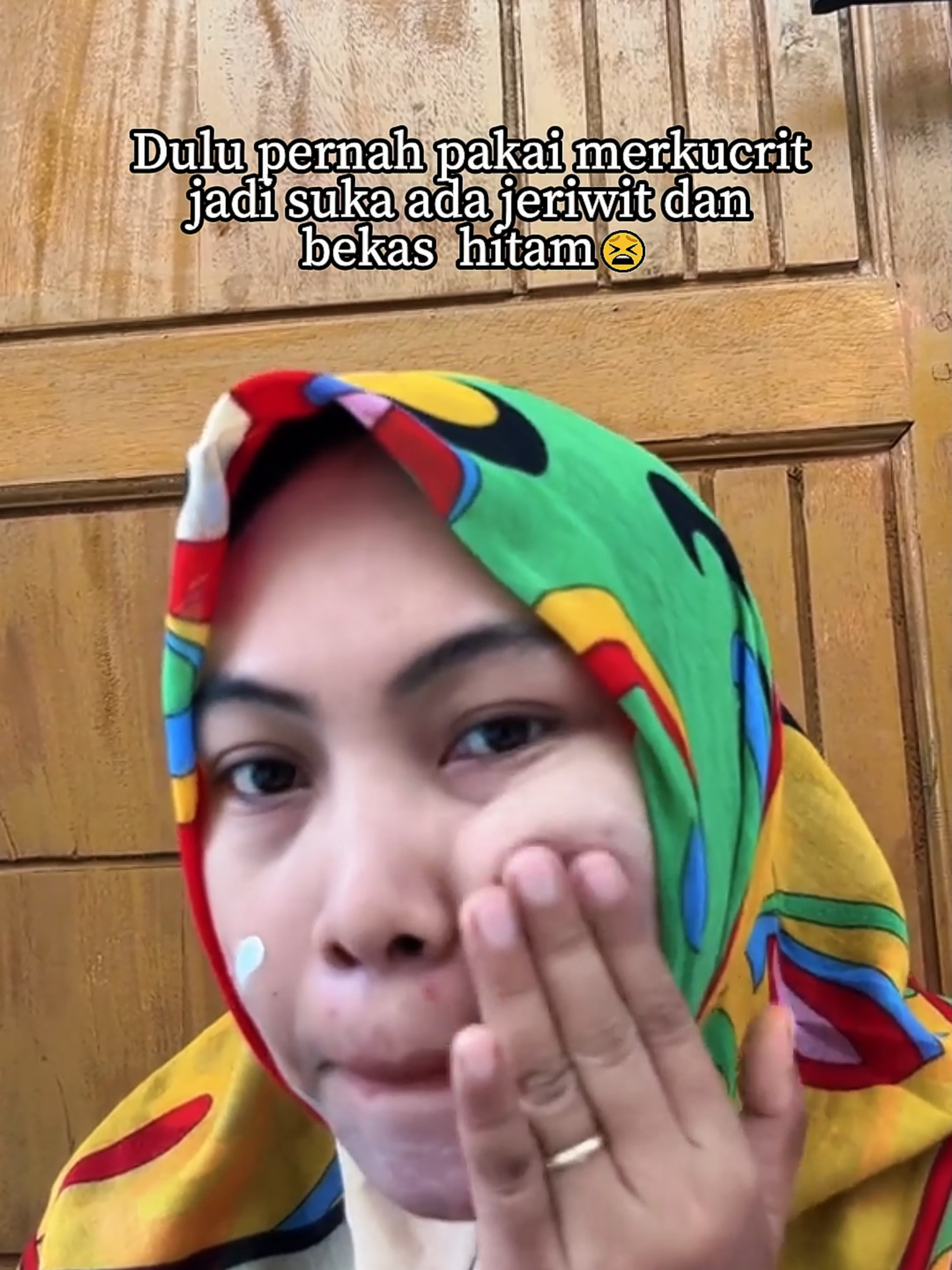 rahasia jiriwit dan bekas hitam di wajah hilang dengan brightening cream chalonese🥰🙌#rekomendasiskincare #bumilbusuiaman🥰 #bpomdanhalal✅ #skincareroutine #fyppppppppppppppppppppppp #masukberanda #viralvideo #kulitglowing #chalonese #kulitsehat #promoskincare #guncang1111 #brighteningcream