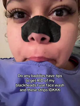 Help a girl out fr #trending #fyp #blackhead #acne #tips 