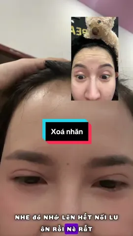 Nguyện tim botox tới cúi cụt đời lung nha mí bà #fillerTrangBom #filler #botoxxoanhan 
