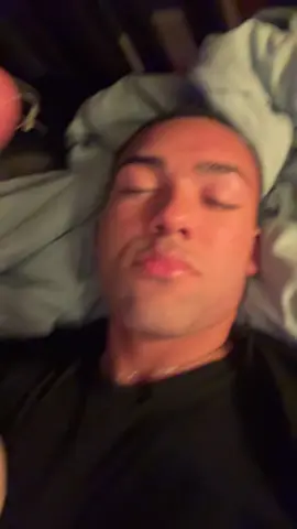 my skin is so dry 🥲. #fyp 