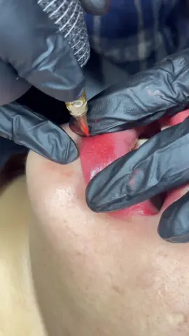 Đây là quá trình m.ô.i từ lúc phun đến 1 tháng sau bong nè🌷🌷 Vừa phun xong m.ô.i khô ráo, quá trình phun m.ô.i siêu siêu nhẹ nhàng, không s.ư.g xíu nào lun😍  Sau khi đủ 1 tháng m.ô.i đã lên màu hồng hào xinh iuuu #odaycomoidep #xh #viral #xuhuong 