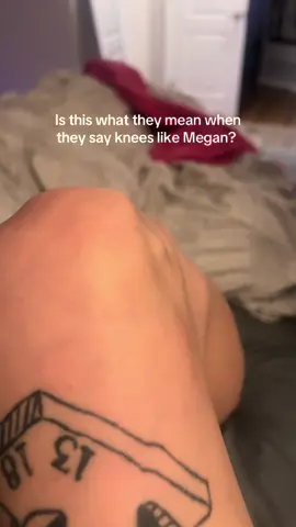 My babyyy my babyyy. #kneeslikemegan #tf #whatthehell #knee 