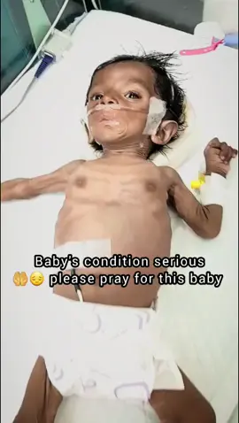 #foryo #viralvideos #fyppp #grow #usa @Nicu tutor001 @🥼BabyStepsNurse🩺 