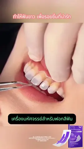 เดี๋ยวก่อน อะไรนะ?! 😳 ปรับผิวกระจ่างใสทันที ขจัดคราบสกปรกบนพื้นผิว เพียงแผ่นเดียว แผ่นฟอกฟันขาวส่วนใหญ่ทำได้อย่างหนึ่ง V34 Whitening Strips ทำได้สองอย่าง ผสาน: 🟣 V34 Colour Correction เพื่อความกระจ่างใสทันที ⚪ PAP+ Whitening ขจัดคราบสกปรกบนพื้นผิว ใช้เวลาเพียง 30 นาที สัมผัสความแตกต่างด้วยตัวคุณเอง!-635696