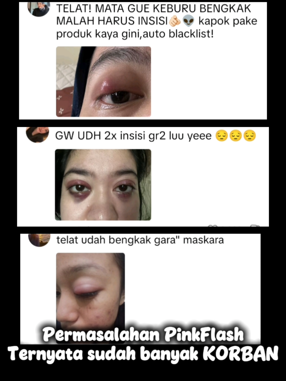 beberapa produk eyeshadow pinkflash ditemukan bpom mengandung pewarna berbahaya sehingga ditarik peredarannya. ternyata sudah memakan banyak korban #pinkflash #makeup #bpom #tidakbpom #kosmetik #viral #mua #eyeshadow #produkpinkflash #foryou #foryoupage #fyp 
