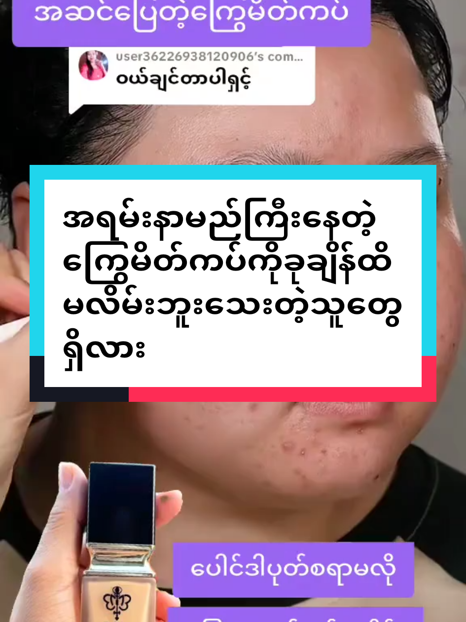 #အမဲစက်၊တင်းတိပ်ရှိသူများအတွက် #ကြွေပုလဲမိတ်ကပ်ရည် #ဆယ်ကျော်သက်ကနေ၇၀ကျော်ထိနုပျိုချင်မှသုံး #bmemyanmar #nandar 