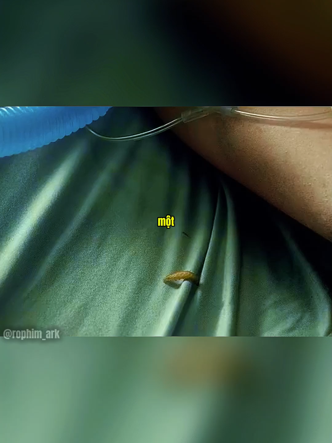 Ấu Trùng Kinh Hoàng Trên Giường Bệnh Nhân| Bí Ẩn Linh Hồn Đáng Sợ P1#phimhaymoinhat #phimhay #reviewphim #rophim_ark