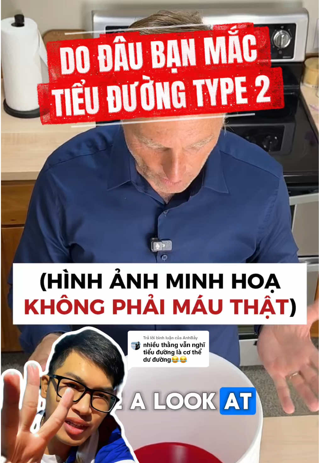 Trả lời @AnhBảy Bạn ko bị tiểu đường type 2 ngay sau 1-2 ngày dư đường, mà nó là kết quả tích lũy của 15-20 năm cỗ máy chuyển hoá cơ thể bị trục trặc #tieuduong #duonghuyet #khanginsulin #roiloanchuyenhoa #glucose 