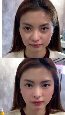 combo trẻ ra 5 đên 10 tuổi cho chị em ăn mãi không béo ạ #xuhuong 