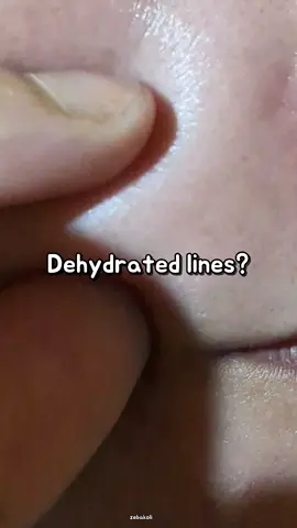 Referral code: 6DF1FD22 🎀 @IUNIK US @IUNIK US @Picky KBeauty  #iunik #gopicky #skincare #SkinCare #koreanskincare 