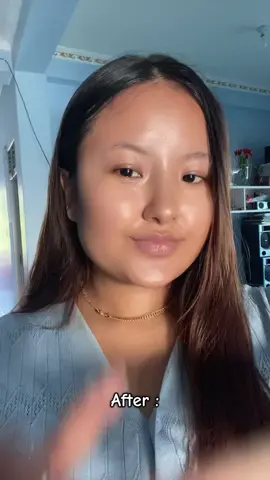 One product that can solve all skin concerns 🫶🏻 @KSECRET GLOBAL #GLOWSHOTCHALLENGE #KSECRET #seoul1988 #hyperpigmentation #darkspots 