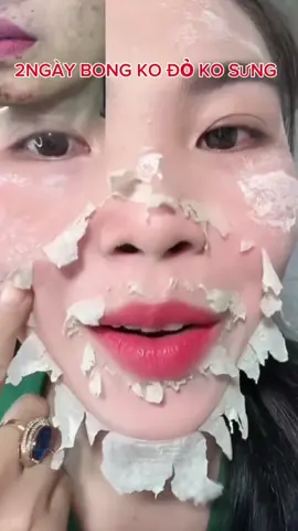 mấy chị thích bông kiểu nào