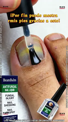 ¿Qué utilizamos para tratar la onicomicosis?  #onicomicosis#nails  #fyp#TikTokShopfalldealsforyou#TikTokShopBlackFriday