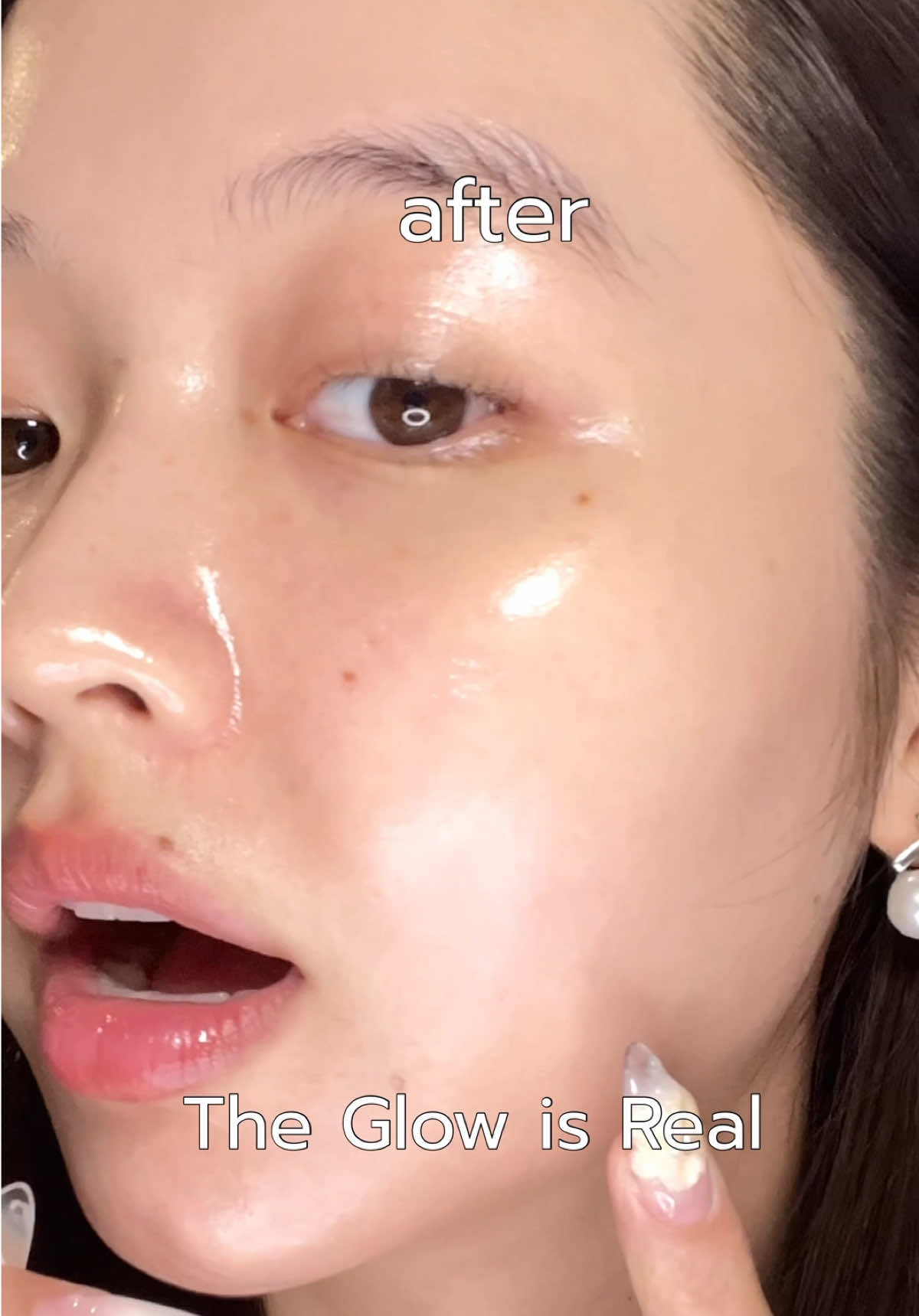 7 days with SomeByMi Retinol Intense @SOMEBYMI Thailand  #Ourglowday #SomeByMi #เรตินอล #มาส์กหน้า #glassskin 