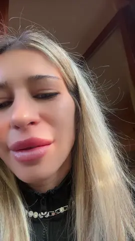 #per #for #frypgシ #romania🇷🇴#gatto 