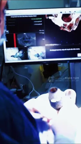 Không răng bẩm sinh:  