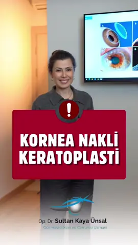 3-9 Kasım Organ Nakli Haftasında  Kornea Nakli nedir? Nasıl yapilir? Kimlere yapılır?  Her bağışlanan kornea yeni bir görüş demektir. #opdrsultankayaünsal #opdrsultankayaünsalmuayenehanesi #korneanakli #korneatransplantasyonu #istanbulgözdoktoru 