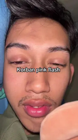 Cepet sembuh sayang biar gak merem muluuu😭 #pinkflash #fyppppppppppppppppppppppp #masukberandafyp #fypシ゚ #fypviralシ 