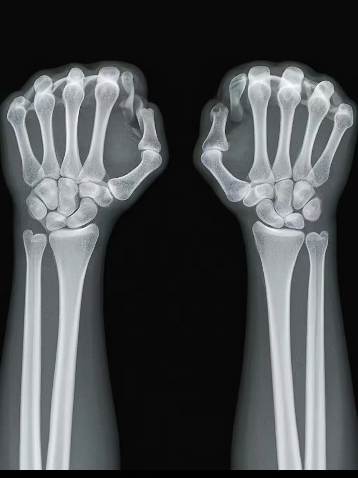 #fyp #racing #gokart 