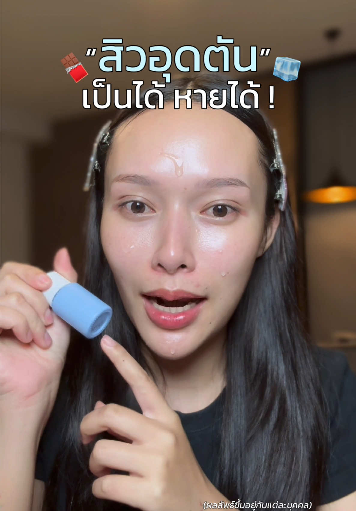 #เซรั่มละลายสิว #เซรั่มละลายสิวblahmbooh #blahmboohthailand #สิวอุดตัน #เซรั่มสิวอุดตัน 