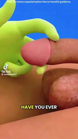 How the Catheter is put into the Penis. Step by Step.