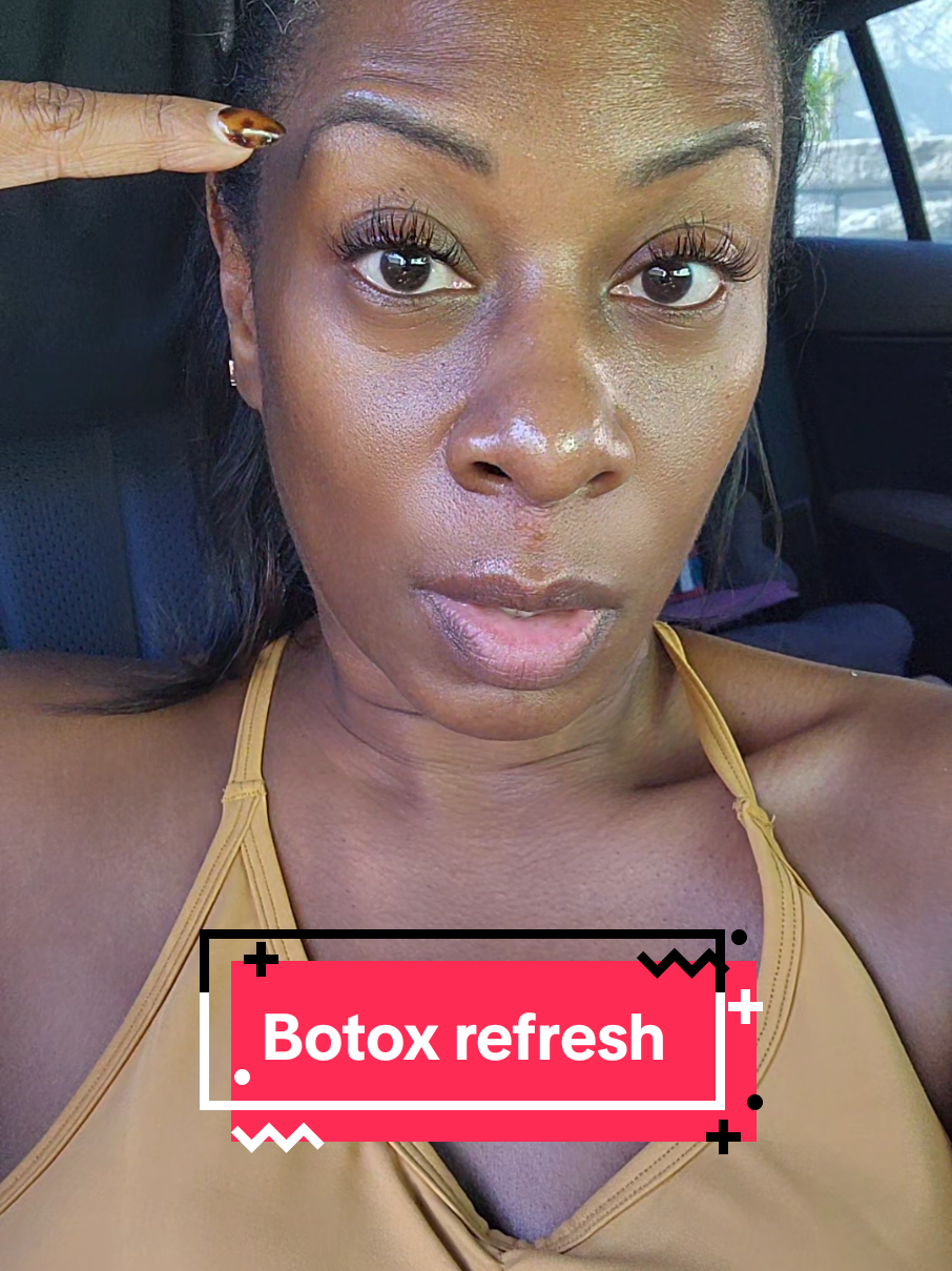 #botox for fine lines and a refreshed looked... I go to a black injector in Los Angeles only because she gets it @Botox Filler Skin Los Angeles  no gate keeping. she and her team are 🤌🏾🤌🏾 im sharing because I dont care if you judge me. Normalize doing wtf YOU WANT!!! 😁 oh and ALWAYS INVEST IN YOURSELF.  you're welcome 😊  #injectables  #blackwomen #skincare #womenover40 