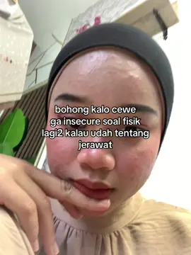 #fyp #acnefighter #jerawatanparah 