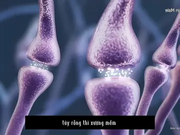 anh em nhớ lưu ý bổ sung nhé #kẽm #suckhoenamkhoa #xuhuong #kemdsd #kẽmada 