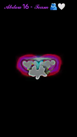 انـتي ماشي ڪــما تمنيـــنك😔وردة حمراء دنييتك❤️‍🩹🥹 #fyp ##duet #foryou #foryoupage #viral 