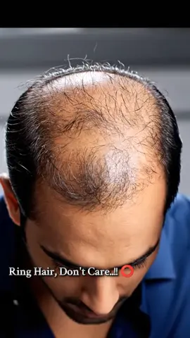 Ring Hair, Don't Care..!! ⭕ .. #hair #spray #satisfyingvideo #asmrhairspraying #FYP 