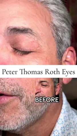 If you want a quick under-eye fix for puffiness, fine lines, or creasing, the Peter Thomas Roth FirmX Eye Tightener is an amazing  temporary smoothing product! It helps tighten, firm, and blur the look of lines and puffiness within minutes, giving a more lifted and smoothed appearance instantly. Perfect for special events, makeup prep, or anyone who wants an instant refreshed look. #undereyebags #wrinkletreatment #peterthomasroth #tiktokshopblackfriday #tiktokshopcybermonday @Peter Thomas Roth Labs 