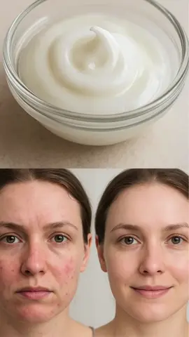 Anti-aging Vaseline cream for glass skin #youthfulskin #wrinkles #antiagingskincare #vaseline #slowaging 