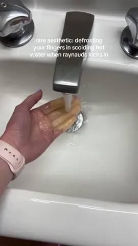 lol i got this as a snap memory from last year and had to post it 😭 #fyp #trending #viral #raynauds 